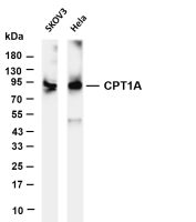CPT1A (PT0640R) PT® Rabbit mAb