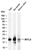 Ferritin Heavy Chain (PT0381R) PT® Rabbit mAb