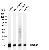 Parvalbumin (PT0155R) PT® Rabbit mAb