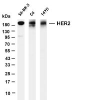HER2 (PT0626R) PT® Rabbit mAb