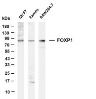 p90RSK (phospho Thr359/Ser363) (PT0755R) PT® Rabbit mAb