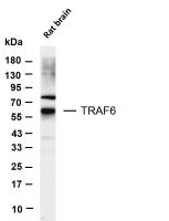 TRAF6 (PT0707R) PT® Rabbit mAb