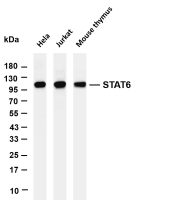 STAT6 (PT0623R) PT® Rabbit mAb