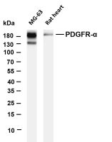PDGFR-α (PT0591R) PT® Rabbit mAb