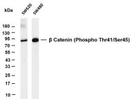 β Catenin (Phospho Thr41/Ser45) (PT0637R) PT® Rabbit mAb