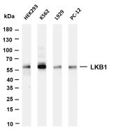 LKB1 (PT0574R) PT® Rabbit mAb
