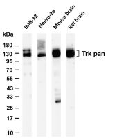 PYK2 (PT0144R) PT® Rabbit mAb