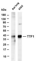 TTF1 (PT0661R) PT® Rabbit mAb