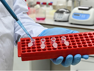 选择合适ELISA试剂盒时应考虑的关键因素有哪些