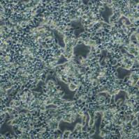 人子宫内膜癌细胞;RL95-2(STR)