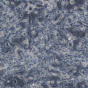 小鼠肺腺癌细胞;LA795(种属鉴定)