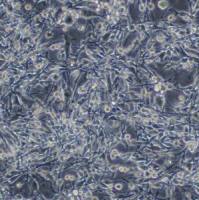 小鼠肺腺癌细胞；LA795（种属鉴定）