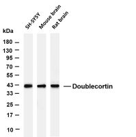 Doublecortin (PT0871R) PT® Rabbit mAb