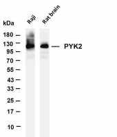 Trk pan (PT0153R) PT® Rabbit mAb