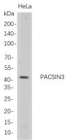 PACSIN3 (PT0794R) PT® Rabbit mAb