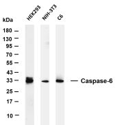 DARPP-32 (PT0500R) PT® Rabbit mAb
