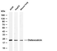 Osteocalcin (PT0763R) PT® Rabbit mAb