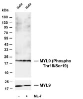MYL9 (Phospho Thr18/Ser19) (PT0752R) PT® Rabbit mAb