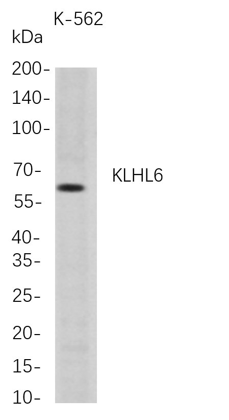 KLHL6 (PT0796R) PT® Rabbit mAb