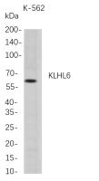 KLHL6 (PT0796R) PT® Rabbit mAb