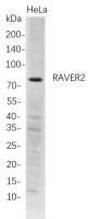 RAVER2 (PT0784R) PT® Rabbit mAb