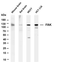 FAK (PT0245R) PT® Rabbit mAb