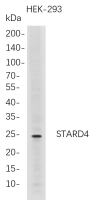 STARD4 (PT0810R) PT® Rabbit mAb