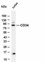 CD34 (PT0716R) PT® Rabbit mAb