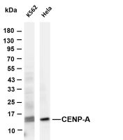 CENP-A (PT0712R) PT® Rabbit mAb