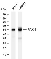 PAX-8 (PT0715R) PT® Rabbit mAb