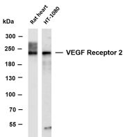 VEGF Receptor 2 (PT0720R) PT® Rabbit mAb