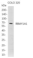 RBMY1A1 (PT0808R) PT® Rabbit mAb
