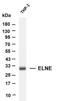 ELNE (PT0880R) PT® Rabbit mAb