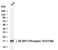 4E-BP1 (Phospho 4E-BP1 (Phospho Thr37/46)) (PT0862R) PT® Rabbit mAb