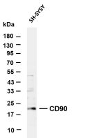 CD90 (PT0844R) PT® Rabbit mAb