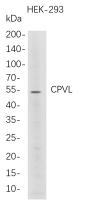 CPVL (PT0813R) PT® Rabbit mAb