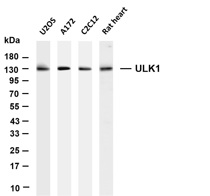 ULK1 (PT0723R) PT® Rabbit mAb