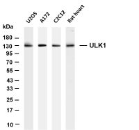 ULK1 (PT0723R) PT® Rabbit mAb