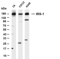 IRS-1 (PT0765R) PT® Rabbit mAb
