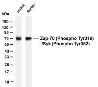 SDHA (PT0711R) PT® Rabbit mAb