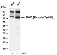 SATB2 (PT0065R) PT® Rabbit mAb