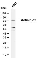 Actinin-α2 (PT0841R) PT® Rabbit mAb