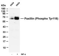 YTHDF2 (PT0674R) PT® Rabbit mAb