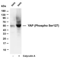 YAP (Phospho Ser127) (PT0743R) PT® Rabbit mAb