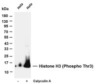 CDKN2A/p14ARF (PT0332R) PT® Rabbit mAb