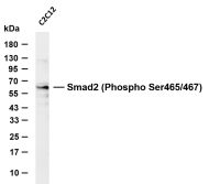 SMAD5 (Phospho Ser463/Ser465) (PT0663R) PT® Rabbit mAb