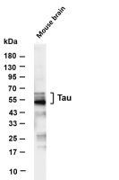 Tau (PT0843R) PT® Rabbit mAb