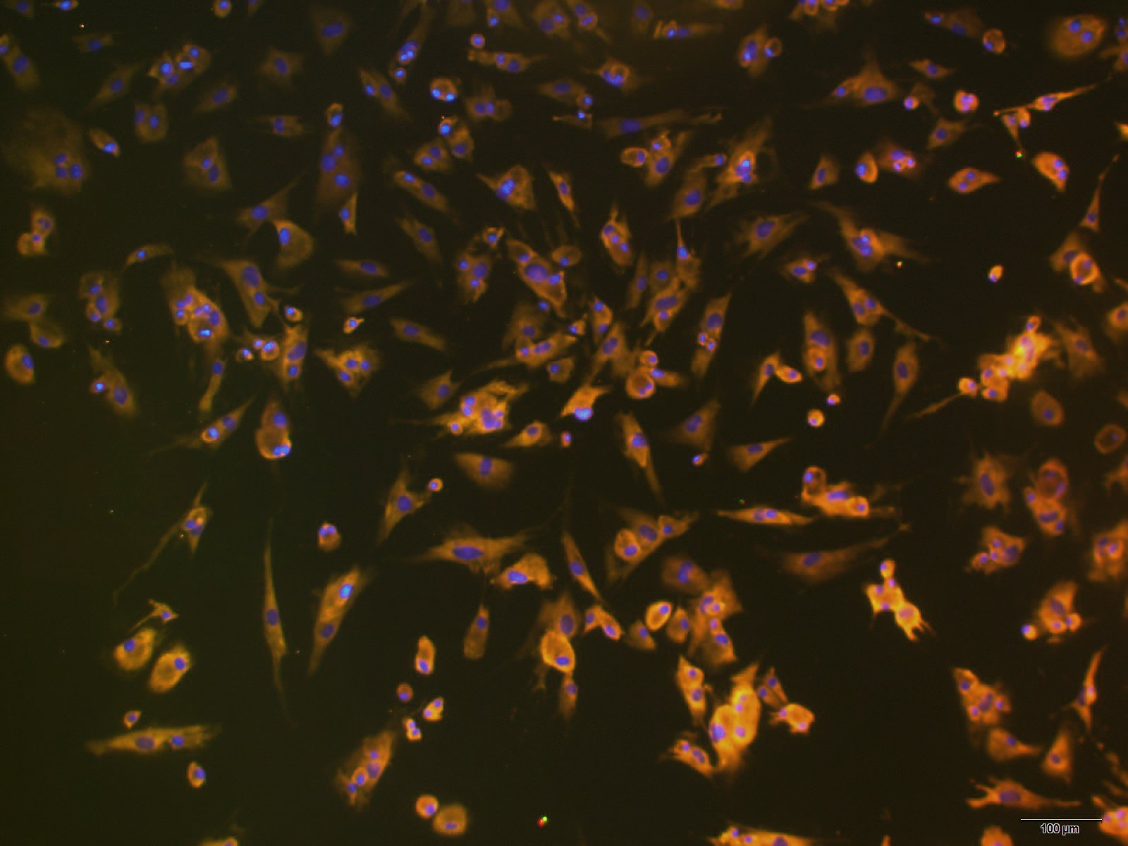 原代肝细胞系列（二）——肝星状细胞（HSCs）
