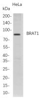 BRAT1 (PT0803R) PT® Rabbit mAb