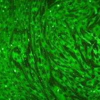 小鼠心脏微血管内皮细胞系、小鼠心肌微血管内皮细胞系、小鼠冠状微血管内皮细胞系、永生化大鼠心脏微血管